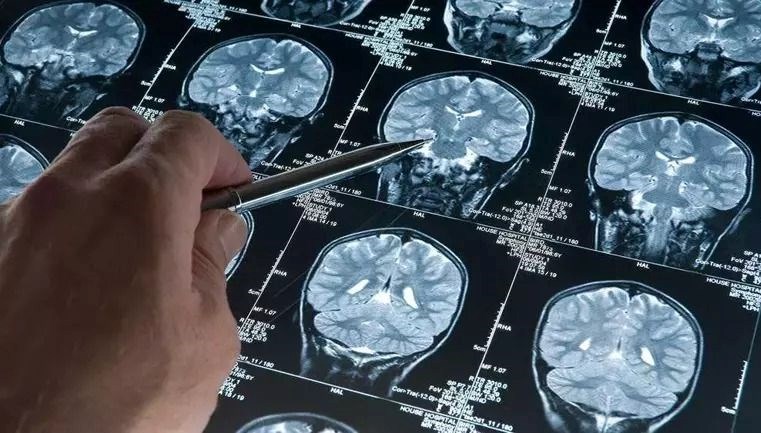 Çin’de bir hafıza kliniğinde misyon yapan nörologlar, 2023 yılında 19