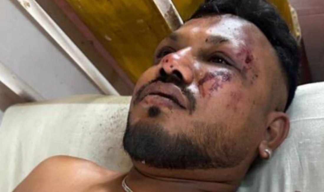 Hindistan'da yaşanan feci uçak kazasından yaralı olarak kurtarılan İngiliz vatandaşı,
