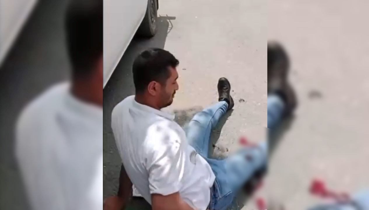 Malatya Pütürge'de kendisini rahatsız ettiğini öne sürdüğü kişiyi bacağından vuran