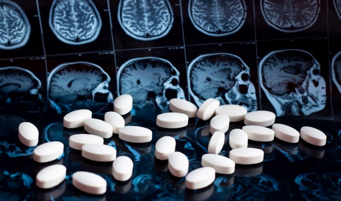 Alzheimer’a karşı geliştirilen yeni jenerasyon bir ilaç, hastalığın tedavisinde ezber