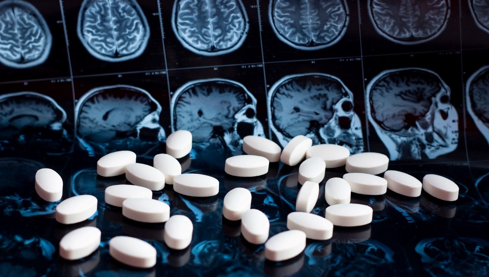 Alzheimer’a karşı geliştirilen yeni jenerasyon bir ilaç, hastalığın tedavisinde ezber