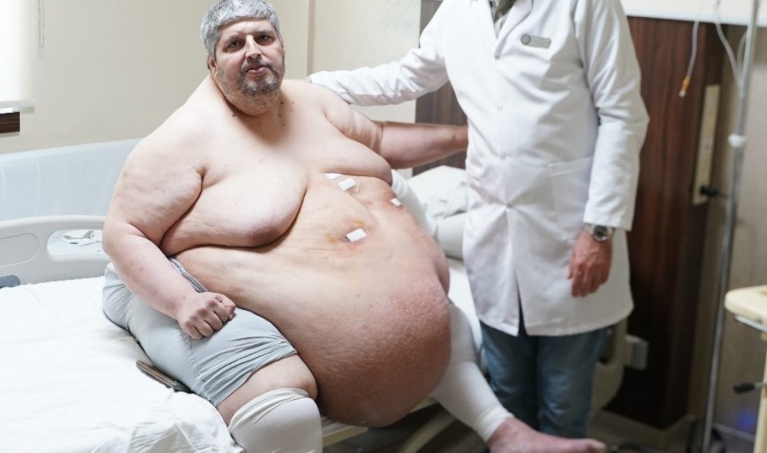 Nazilli ilçesinde, yatağa bağımlı ömür süren 310 kiloluk hasta, ağır