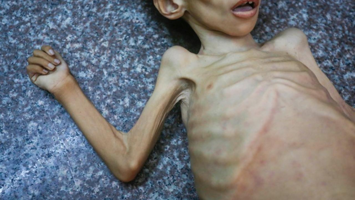 Gazze Şeridi'nde son 24 saatte 1'si çocuk 14 Filistinlinin daha