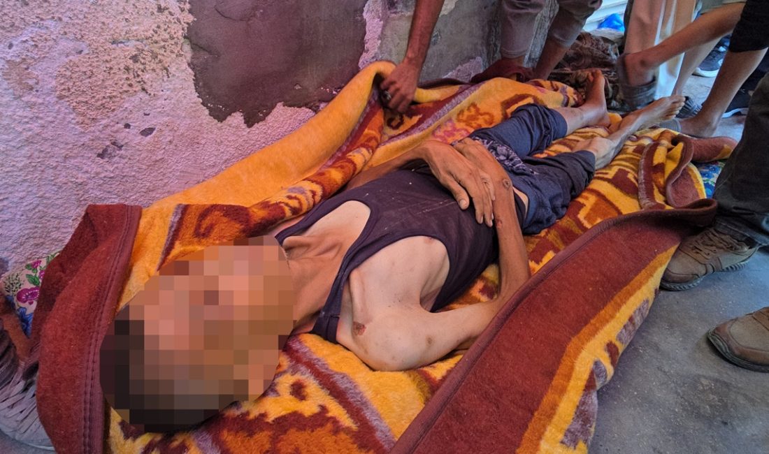 Gazze'de açlıktan vefatlar sürüyor. Gelen imgeler, bölgede yaşananların en büyük