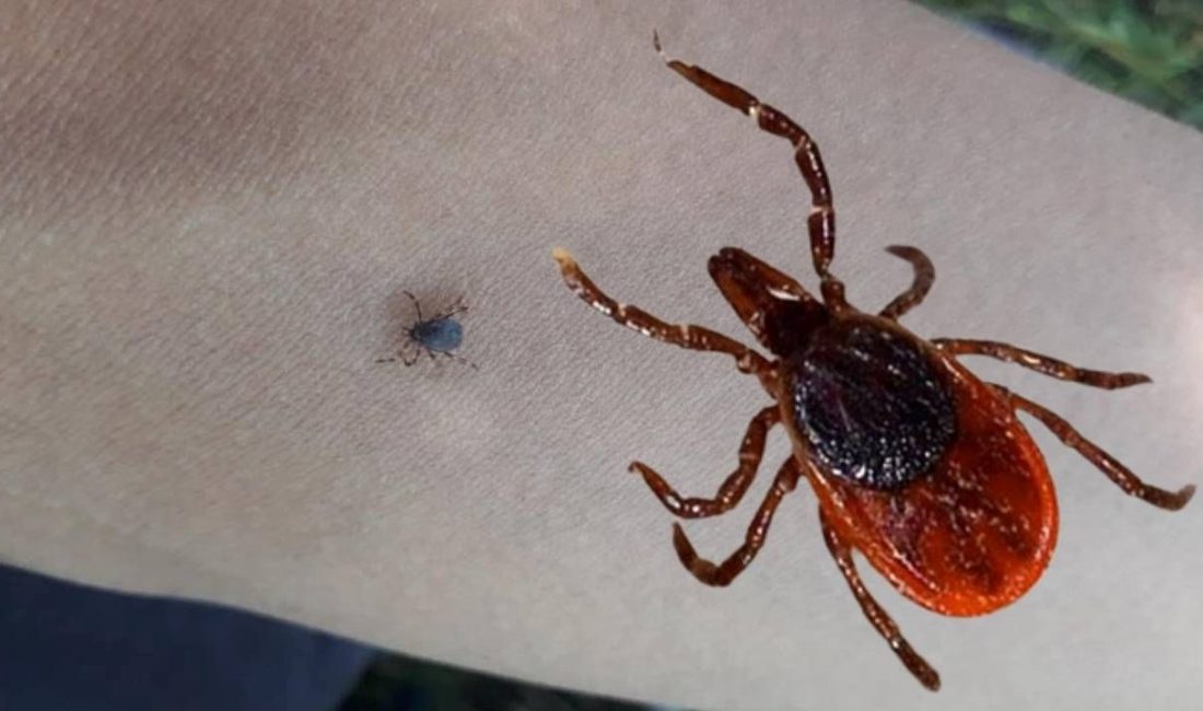 Sivas'ta kene kabusu sürüyor. Vücuduna yapışan keneyi sıhhat kuruluşunda çıkartmasına karşın,