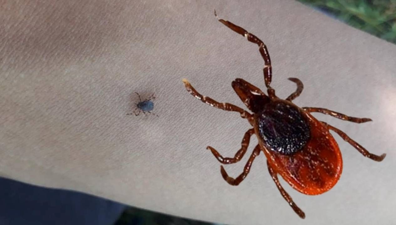 Sivas'ta kene kabusu sürüyor. Vücuduna yapışan keneyi sıhhat kuruluşunda çıkartmasına karşın,