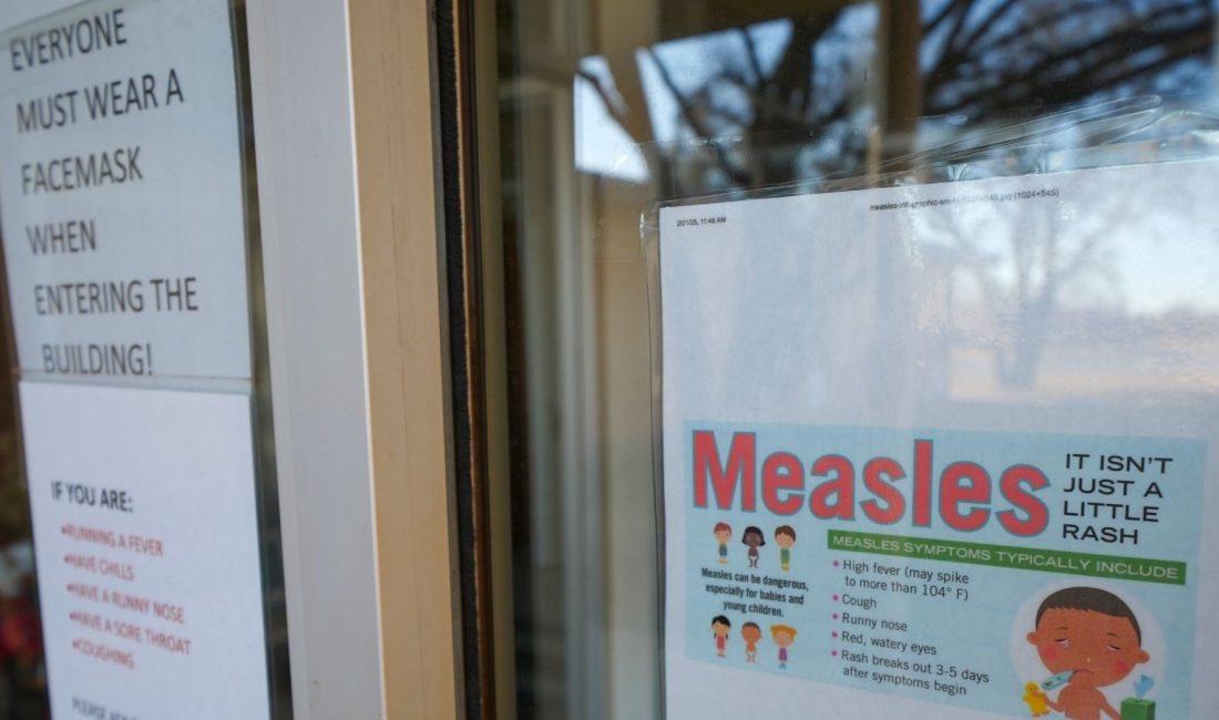 Kızamık olaylarının son 33 yılın doruğuna çıktığı ABD’nin akabinde İngiltere’de