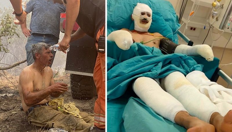 Eskişehir'de orman yangınlarıyla çaba sırasında toplumsal medyada "Yanıyorum, su verin"