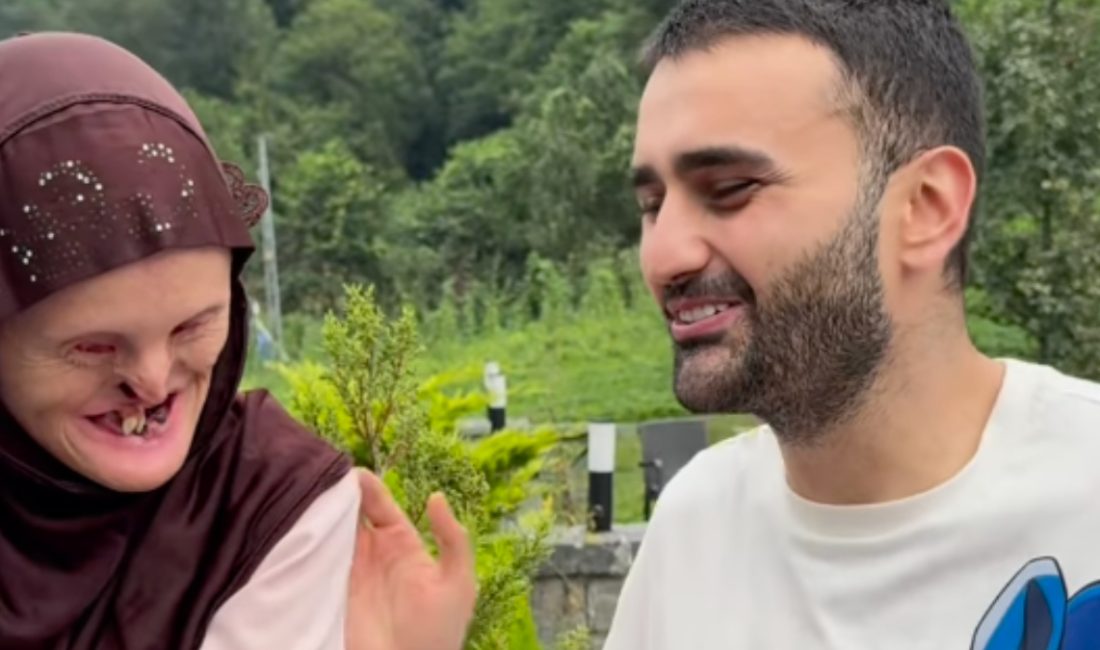 Milyonlarca insanın gönlünde taht kuran iş insanı Burak Özdemir, yanık