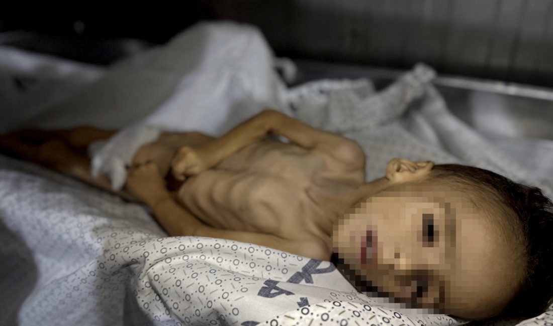 Gazze Şeridi'nde, 5 yaşındaki Muhammed Zekeriya Hıdır isimli çocuk, yetersiz