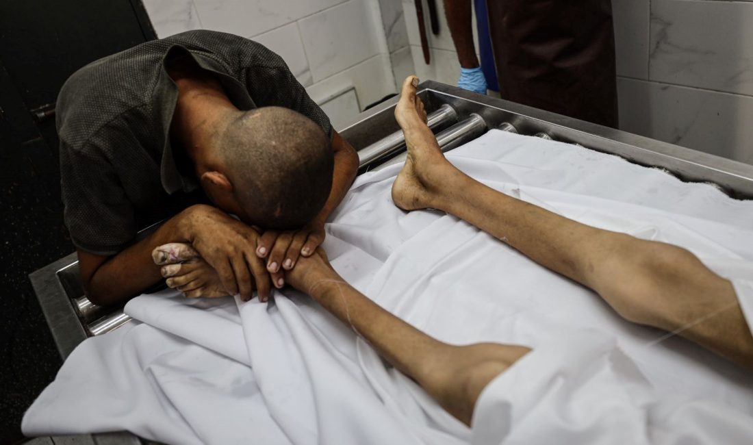17 yaşındaki Filistinli çocuk Atıf Ebu Hatır, 25 kiloya kadar düştü.