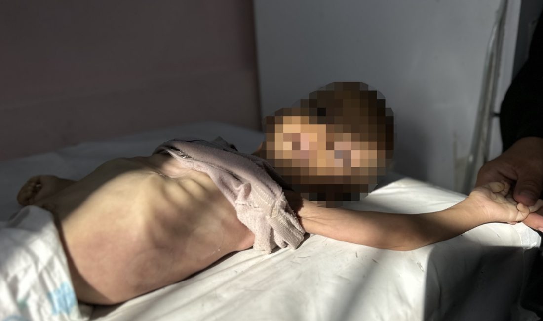 İsrail'in taarruzları ve ablukası nedeniyle kıtlık yaşanan Gazze Şeridi'nde son
