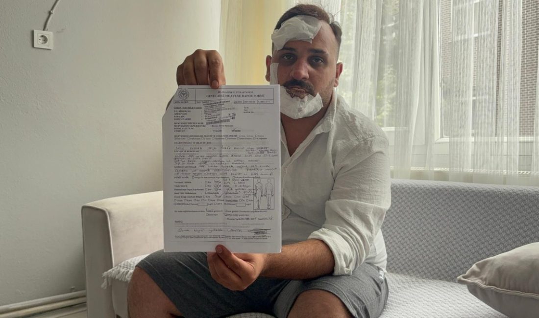 Dilovası ilçesinde taksi sürücülüğü yapan Serhat Aydemir, eski sözlüsü İ.D.