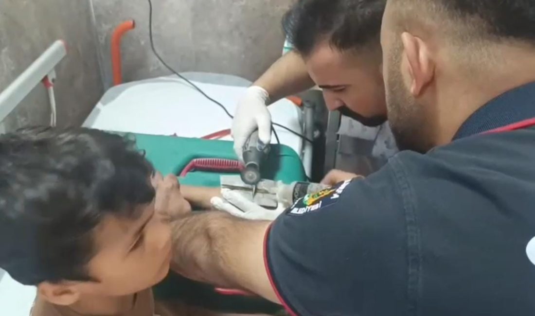 Şanlıurfa’da 10 yaşındaki çocuğun parmağına sıkıştırdığı cıvata pulu, doktor nezaretinde