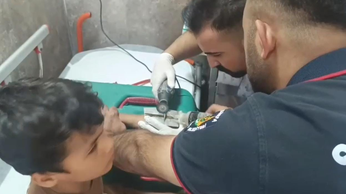 Şanlıurfa’da 10 yaşındaki çocuğun parmağına sıkıştırdığı cıvata pulu, doktor nezaretinde