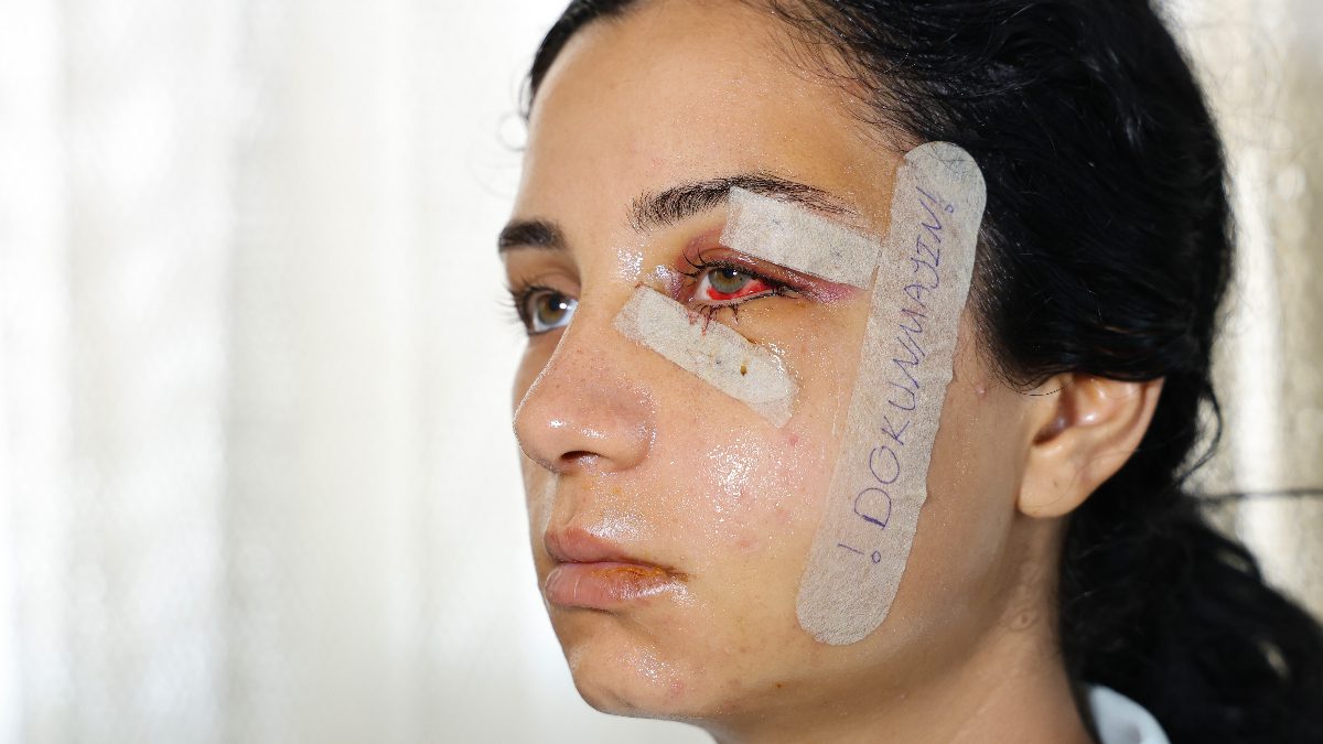 Adana'da eski eşini, kızının gözleri önünde dövdükten sonra gözaltına alınıp