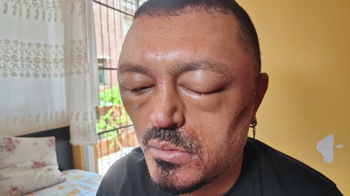 Seyhan ilçesinde saçlarını beyazlardan kurtarmak isteyen Murat Gözde isimli vatandaşın