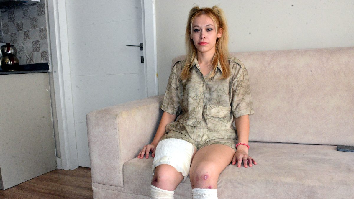 Tırın çarpması sonucu bacaklarını kaybeden fitness eğitmeni İrem Karatutlu, tedavisinin