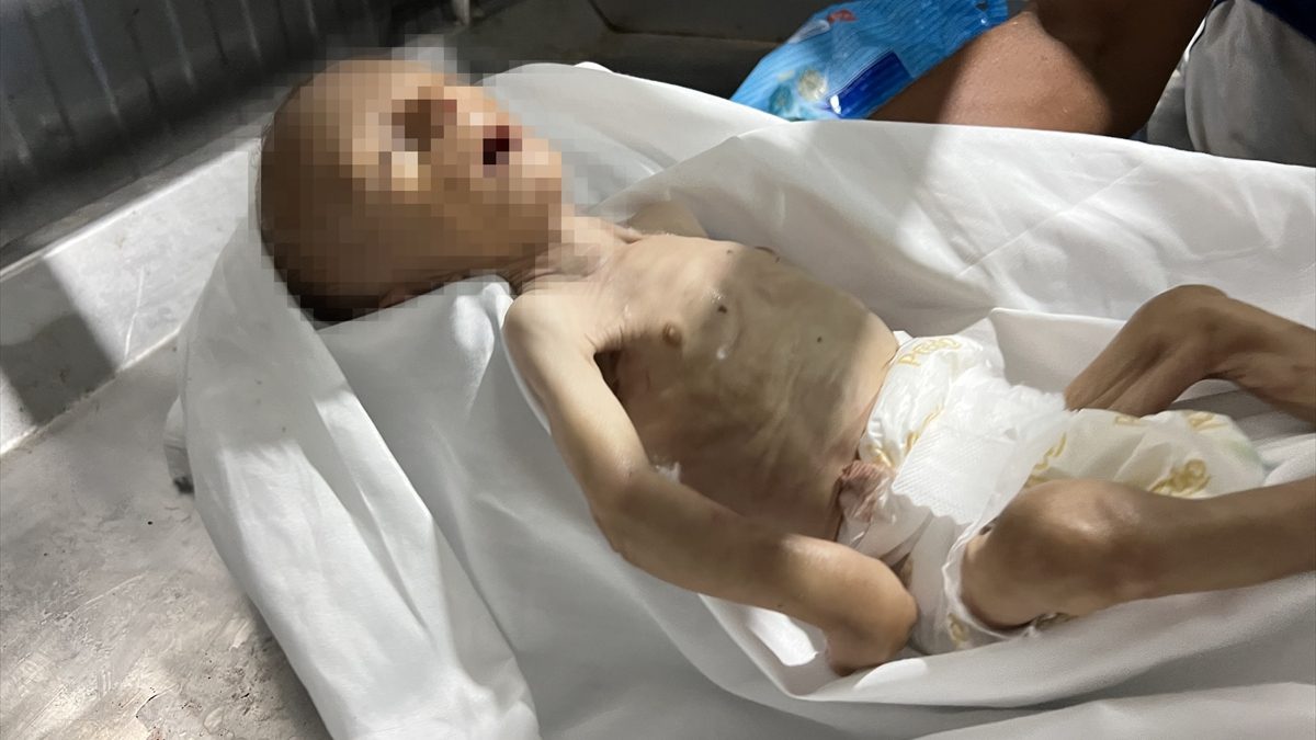 İsrail'in abluka politikalarıyla temel gıda malzemelerine erişimi engellediği Gazze'de, 2.5