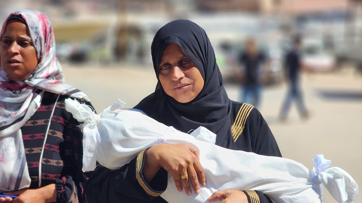 Gazze Şeridi'nde 4 yaşındaki Filistinli Hala el-Hanedi, skleroderma (deri sertleşmesi)