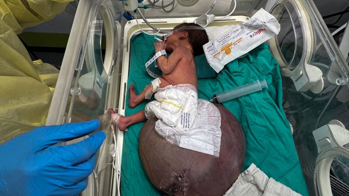 İsrail'in uyguladığı tam ambargo nedeniyle ağır insani krizin yaşandığı Gazze
