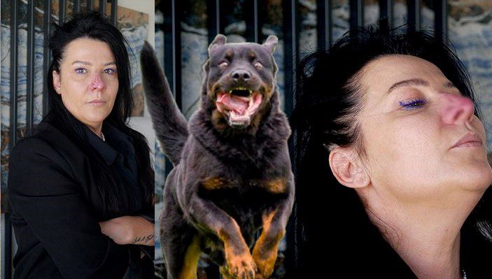 Bursa'da yaşayan estetisyen Huriye Abikebahşi'nin, arkadaşının rottweiler cinsi köpeğinin saldırısı