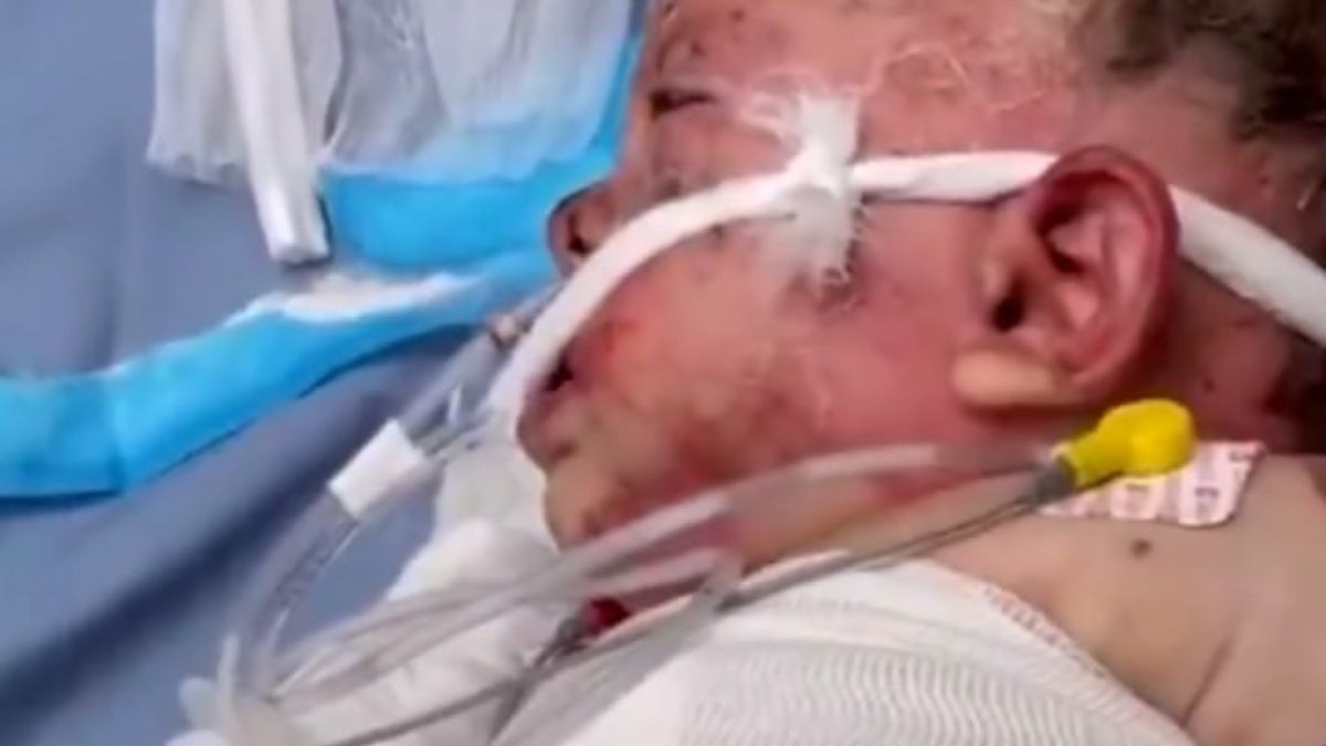 Masum sivilleri hedef almaya devam eden İsrail'in bombardımanında annesini, babasını,