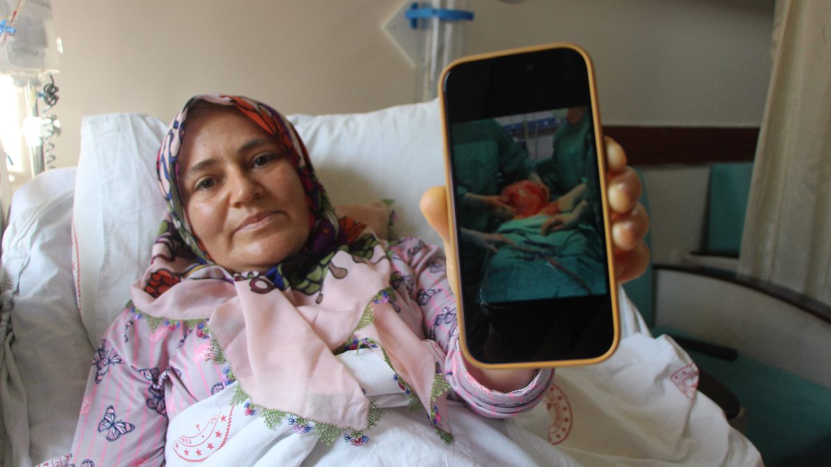 Göynücek ilçesinde, karnının 2 ayda karpuz büyüklüğünde büyümesi üzerine hastaneye