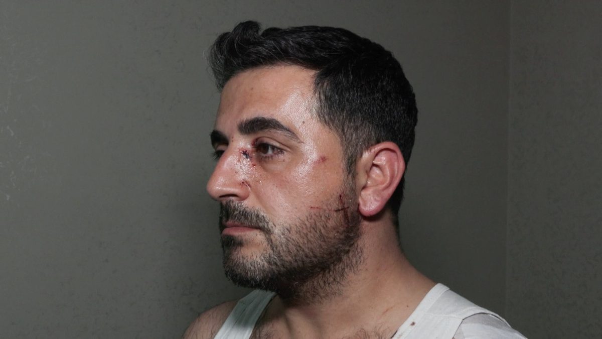 İstanbul Esenyurt'ta bir kiracı boşalttığı evin sahibini bıçakla yaraladı. Yaralanan