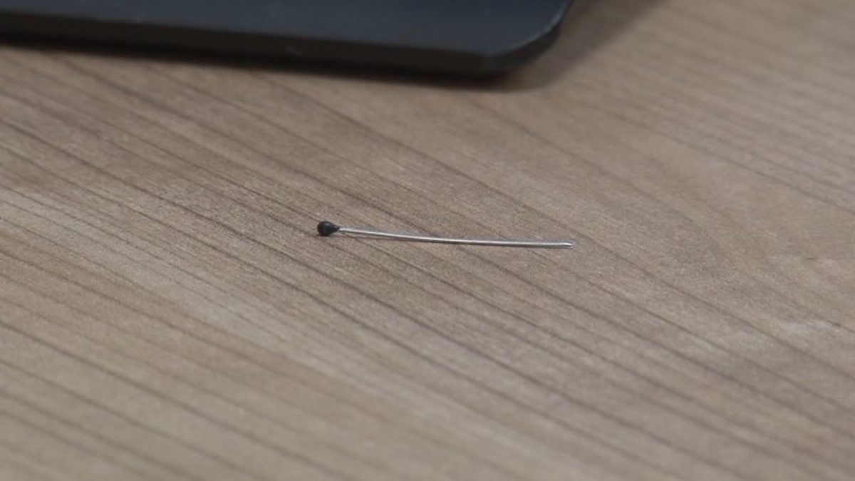 İstanbul'da, karın ağrısı şikayetiyle hastaneye götürülen 2 yaşındaki bebeğin bağırsakalarında