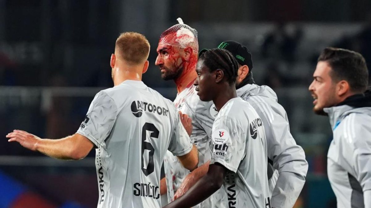 Kocaelispor’un deneyimli golcüsü Serdar Dursun, Başakşehir maçında yaşadığı kafa çarpışmasının