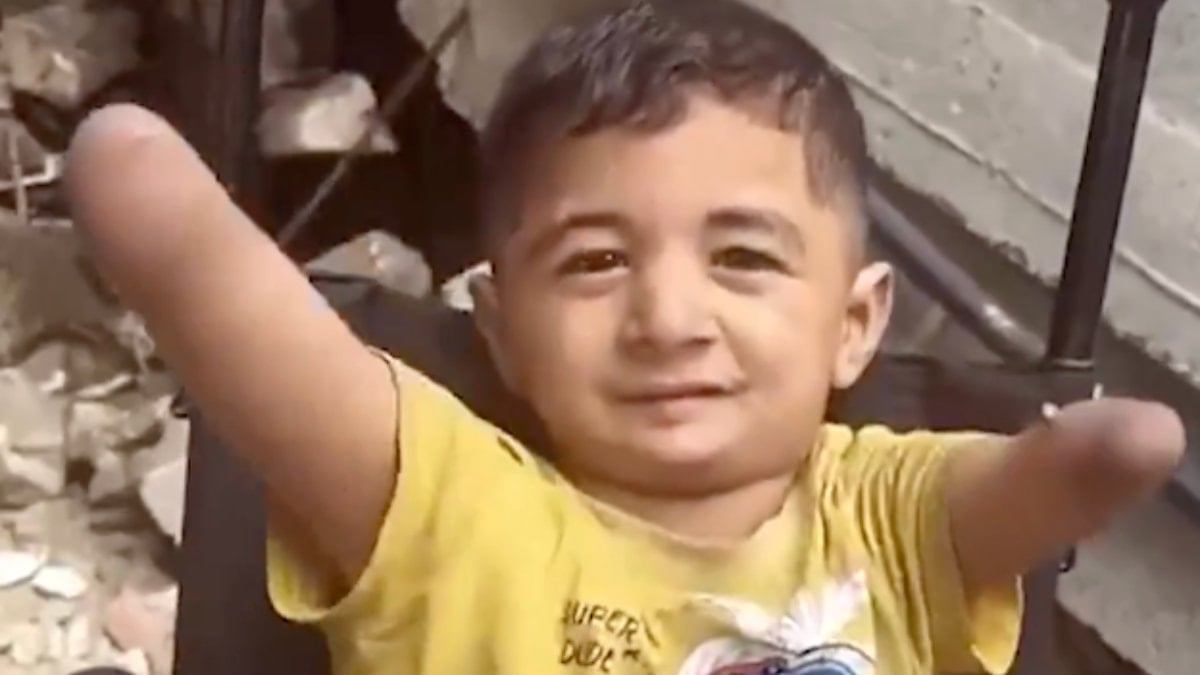 Masum sivilleri hedef almaya devam eden İsrail'in bombardımanında uzuvlarını kaybeden