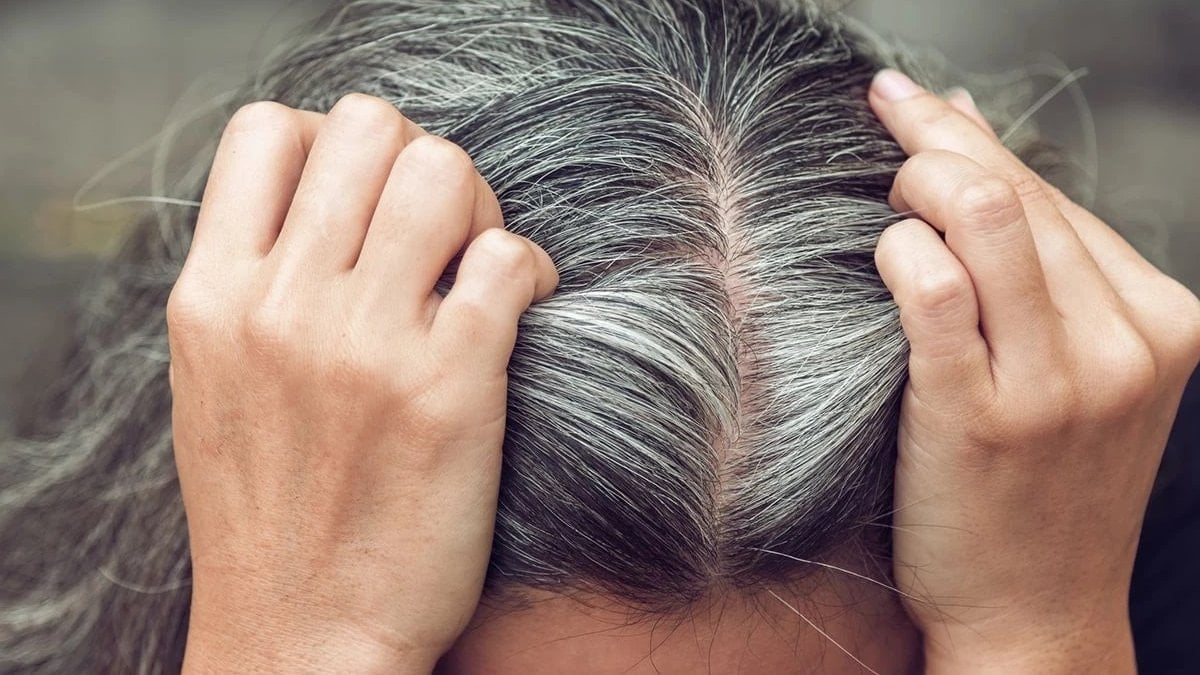 Beyaz saçlar çoğu zaman yaşlanmanın doğal bir sonucu olarak görülse