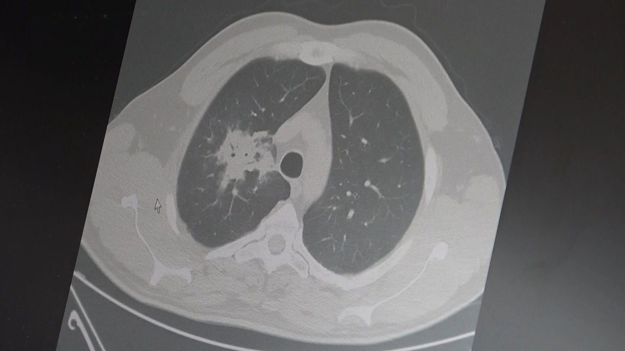Prof. Dr. Şevket Özkaya, elektronik sigaralarla ilgili beklenen '20 -