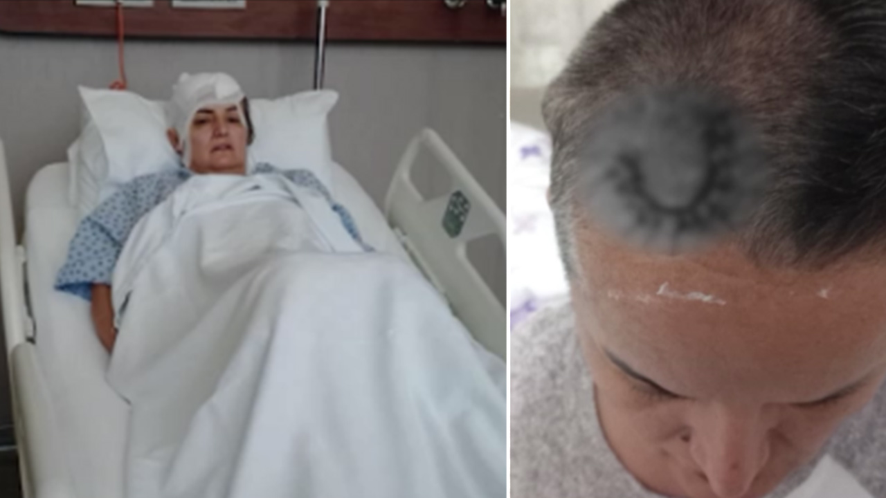 İstanbul Ataşehir'de 48 yaşındaki Tülay Kızmaz, dişini implant tedavisi yaptırmak