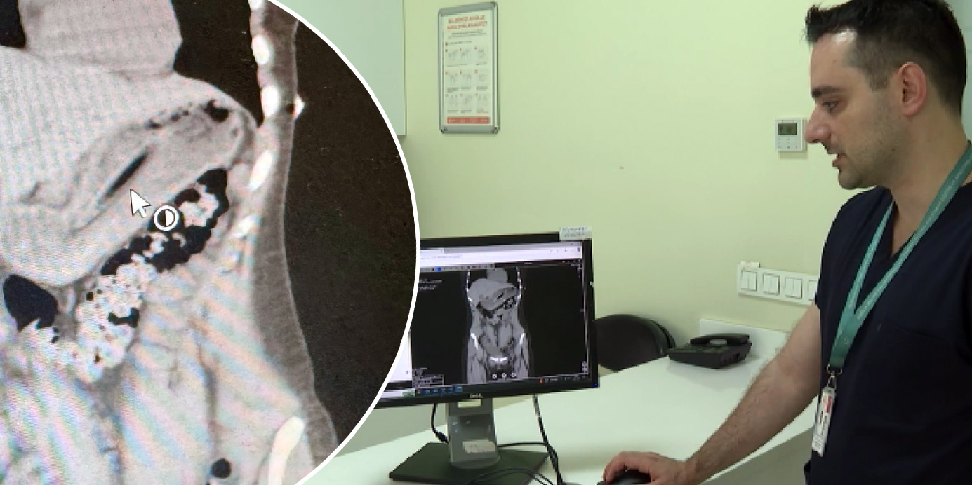 İstanbul'da zayıflamak için kendisini kusturmaya çalışan kadının uyguladığı yöntem doktorları
